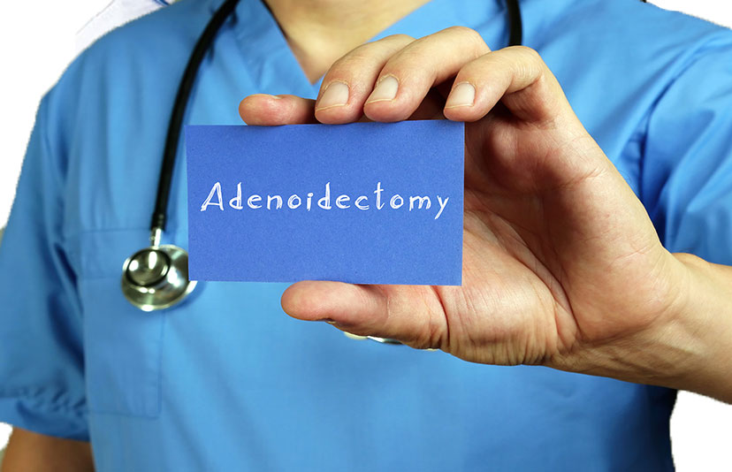 adenoidectomy